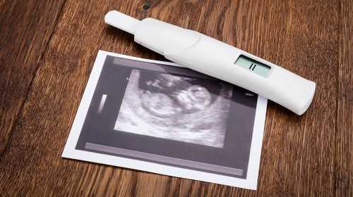 温州代生捐卵 温州中山医院试管婴儿费用明细 ‘通过孕囊值看男女’