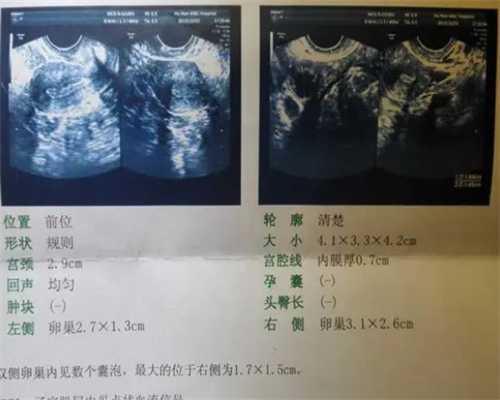 武汉专业的代孕机构,武汉协和做试管费用(武汉协和2023试管费用)
