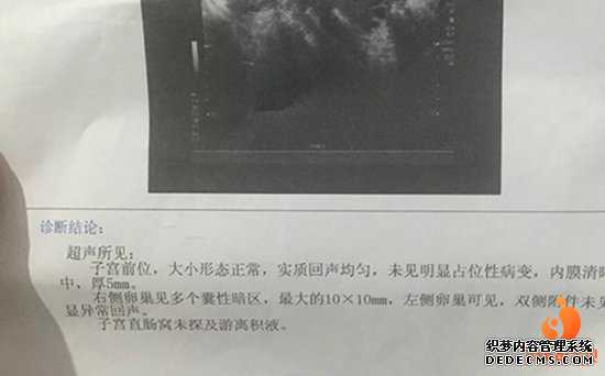 捐卵互动_【广州哪家医院可以做供卵试管婴儿】医生询问以前有没有做过什么